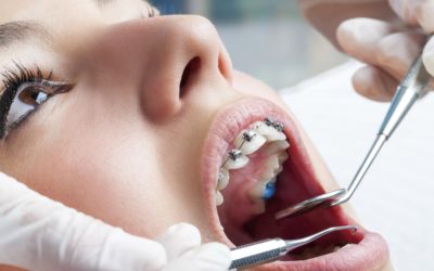 L’orthodontie en quelques mots